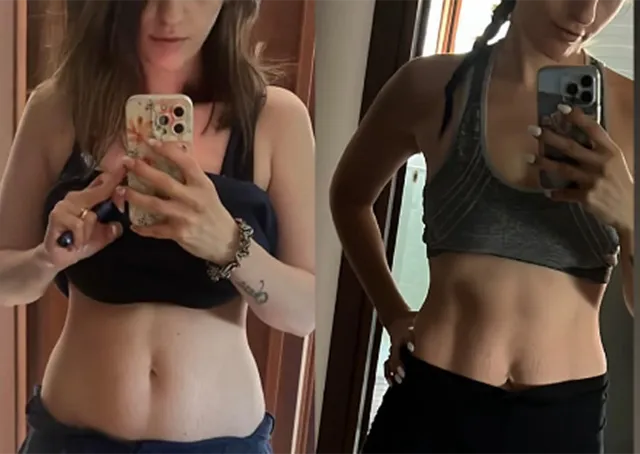 Foto prima e dopo di Angela, che ha perso 7kg con il Pilates Linfodrenante