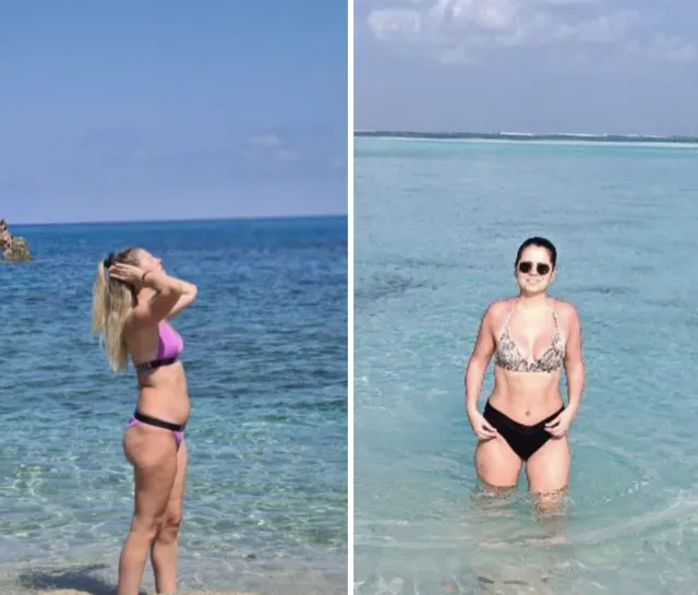 Foto prima e dopo di Giulia P. dopo 3 anni di Pilates Linfodrenante
