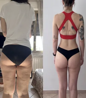 Roberta before and after with Traininpink Lymphatic Drainage Pilates
