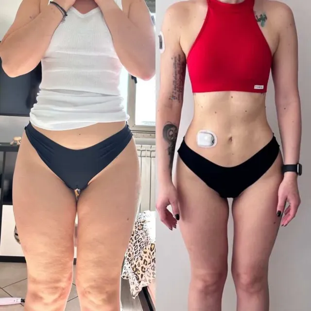 Foto prima e dopo di Roberta dopo 1 anno di Pilates Linfodrenante