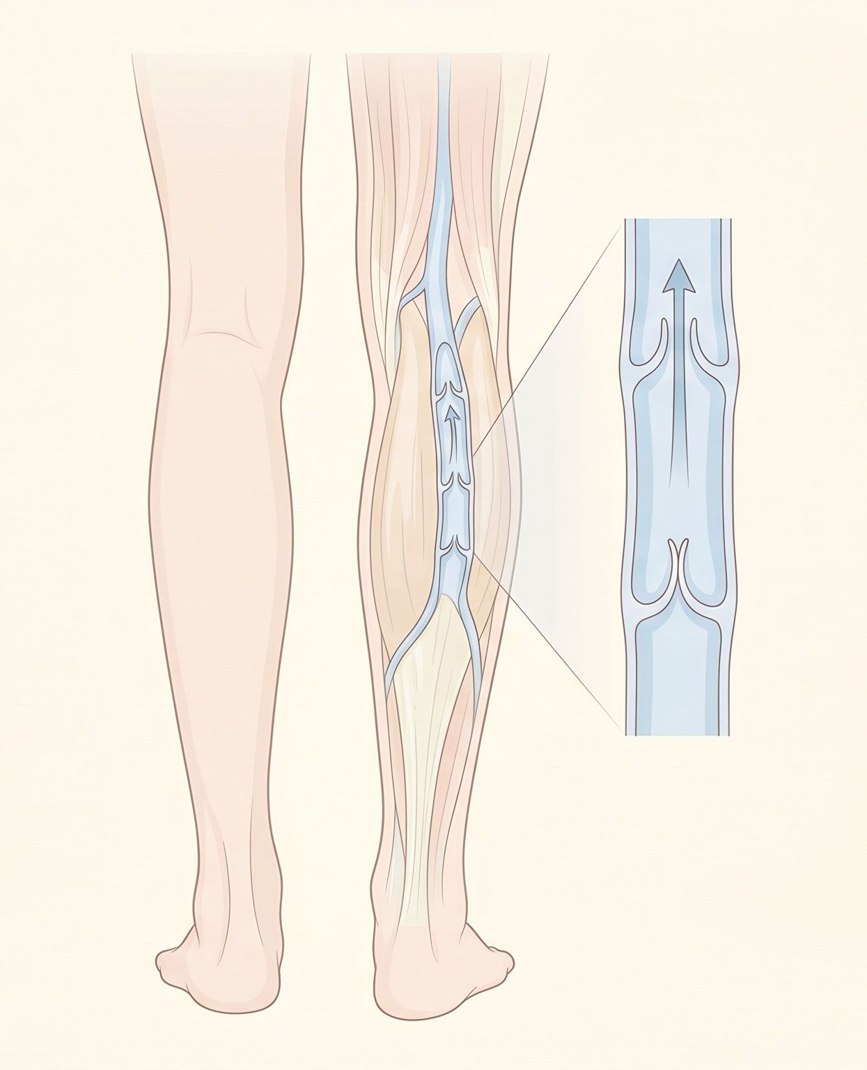 Illustrazione anatomica delle valvole venose nelle gambe che regolano il ritorno venoso verso il cuore, causa principale delle gambe pesanti e gonfie a fine giornata