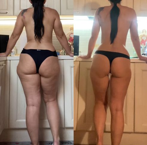 Schiena di Ilaria prima e dopo 3 mesi di Pilates Linfodrenante