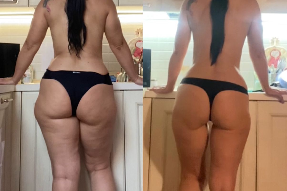 Trasformazione del corpo di Ilaria prima e dopo 3 mesi di Pilates Linfodrenante