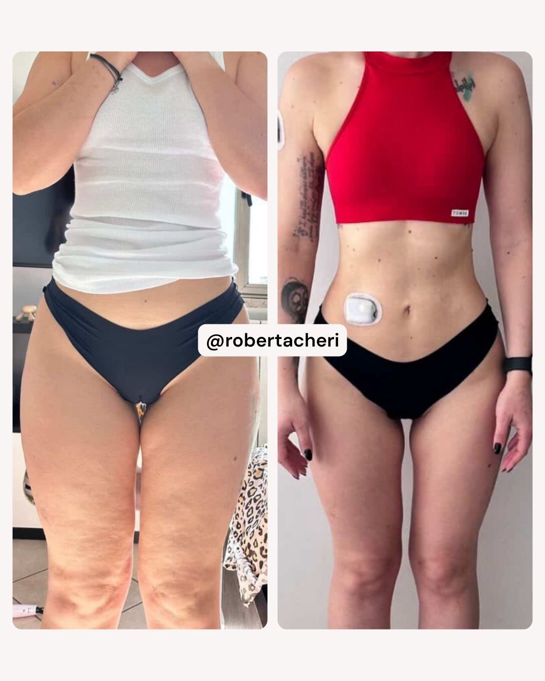 Trasformazione di Roberta in 1 anno di Pilates Linfodrenante