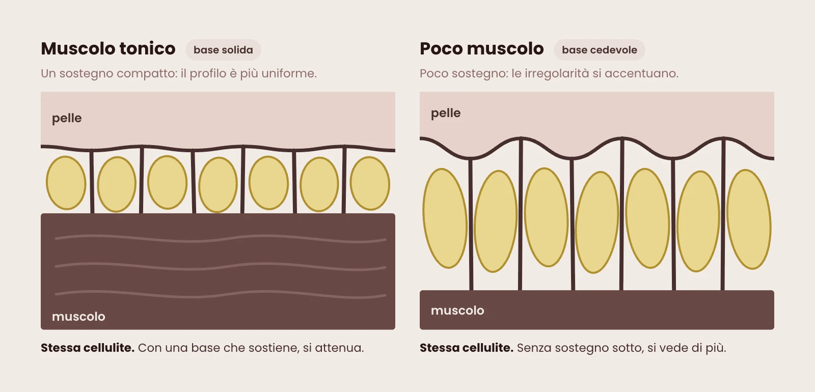 La stessa pelle appoggiata su muscolo tonico e su poco muscolo: con una base solida il profilo è più uniforme, senza sostegno le irregolarità si accentuano.