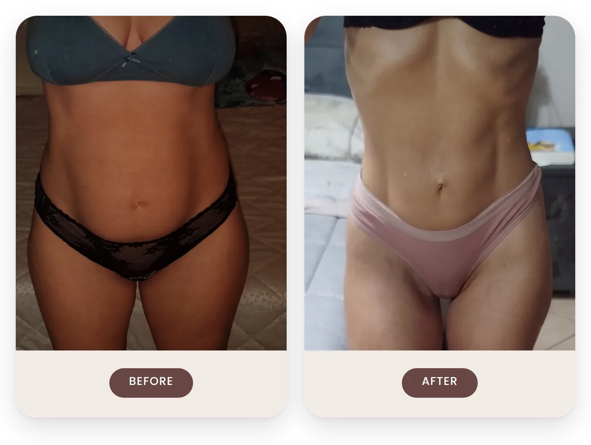 Miriam before and after one year of Lymphatic Drainage Pilates at home, after two pregnancies