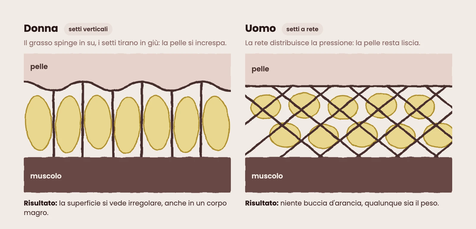 Sezione del tessuto sotto la pelle: nella donna i lobuli di grasso stanno tra setti fibrosi verticali e la pelle si increspa, nell'uomo i setti sono obliqui e incrociati, a rete, e la pelle resta liscia.