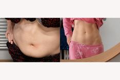 why you are still bloated after giving birth.jpg